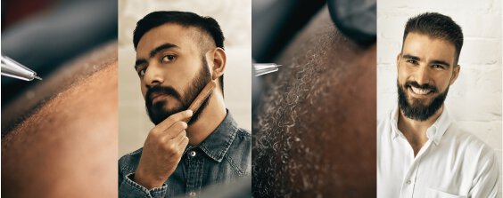 Beard Micro-Pigmentation